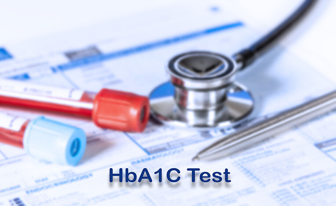 Haemoglobin A1C test, conceptual image