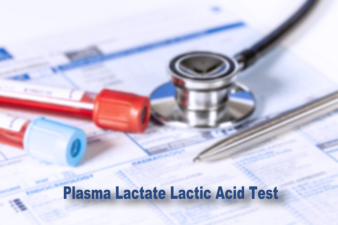 Plasma lactate lactic acid test, conceptual image