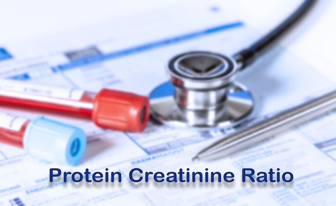 Protein creatinine ratio test, conceptual image