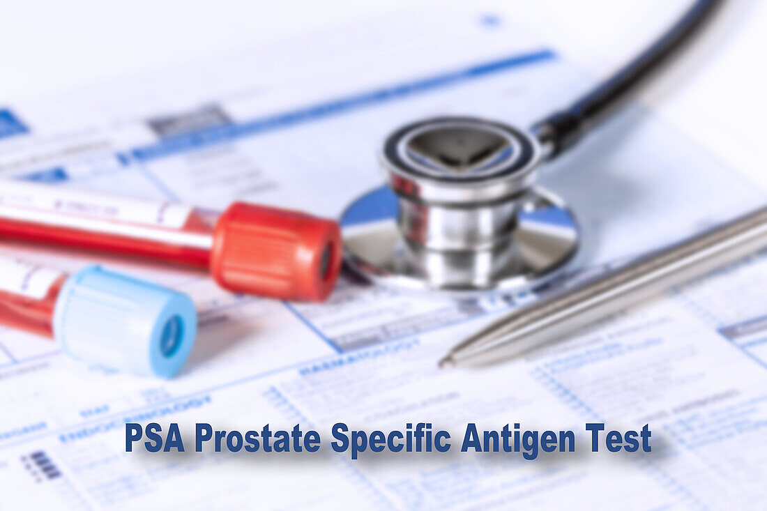 Prostate specific antigen test, conceptual image