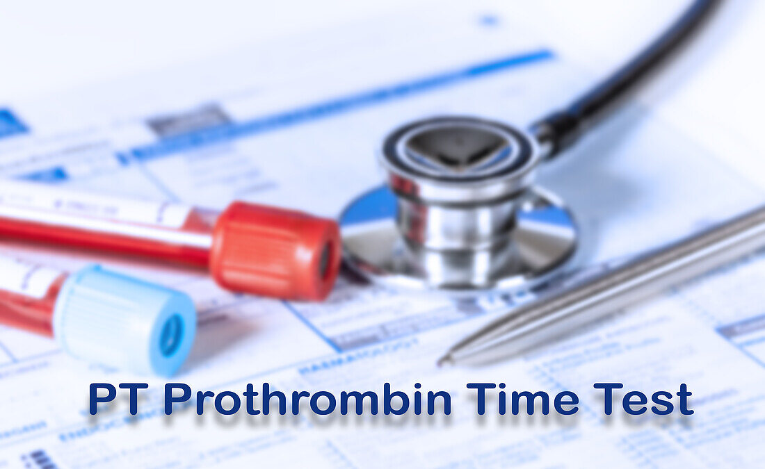 Prothrombin time test, conceptual image