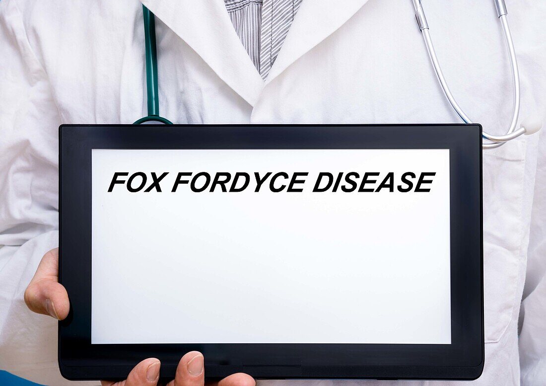 Fox-Fordyce disease, conceptual image