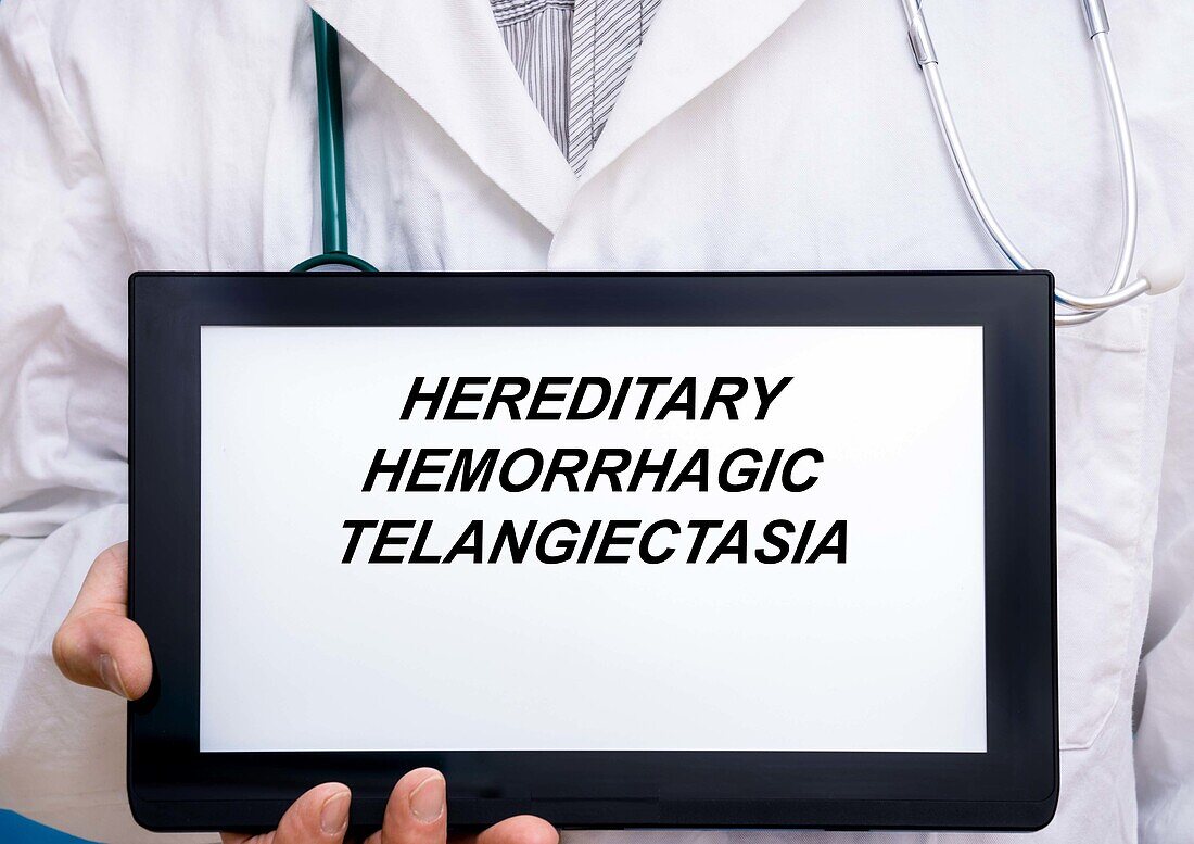 Hereditary haemorrhagic telangiectasia, conceptual image