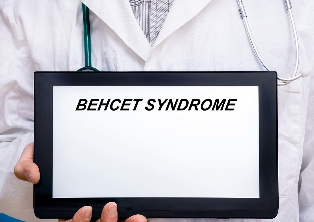 Behcet syndrome, conceptual image