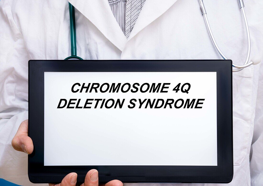 Chromosome 4q deletion syndrome, conceptual image