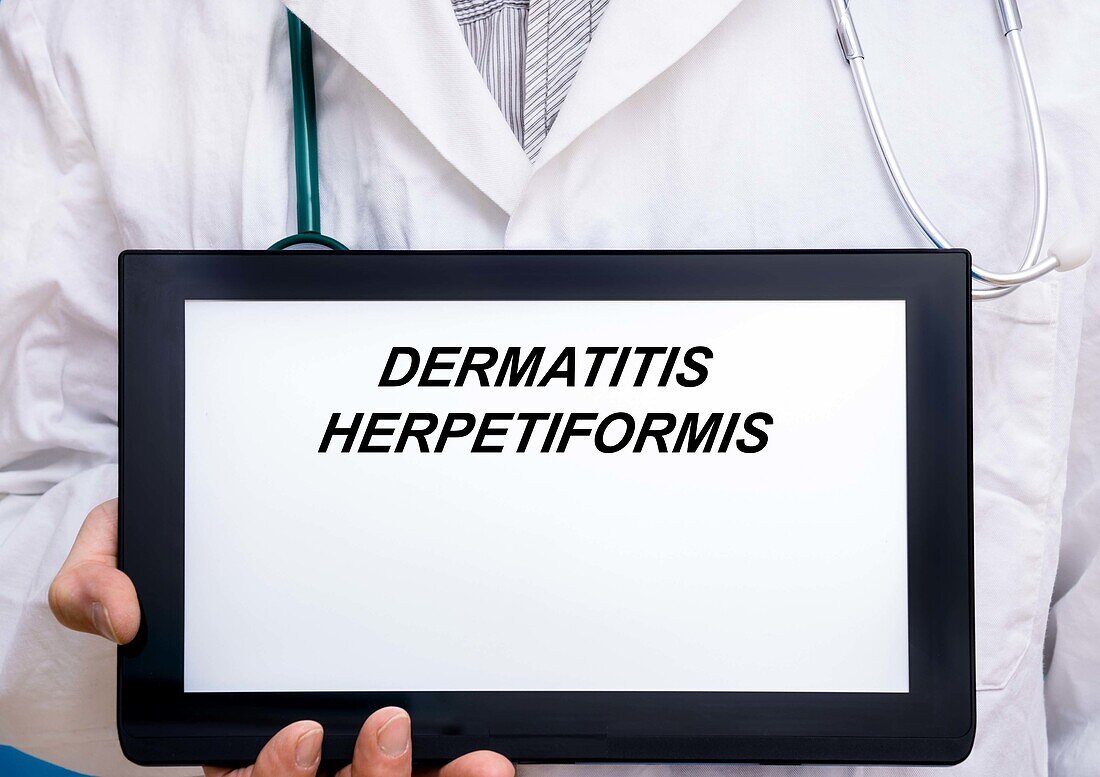 Dermatitis herpetiformis, conceptual image