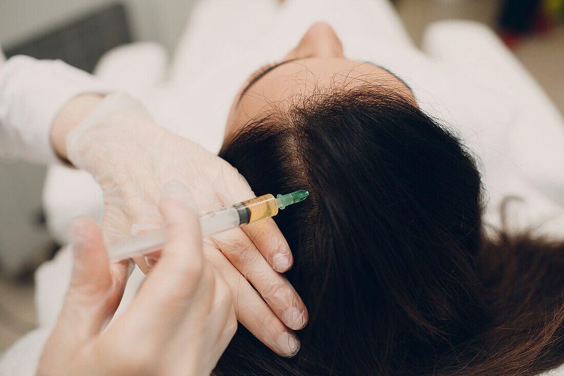 Cosmetic scalp injection