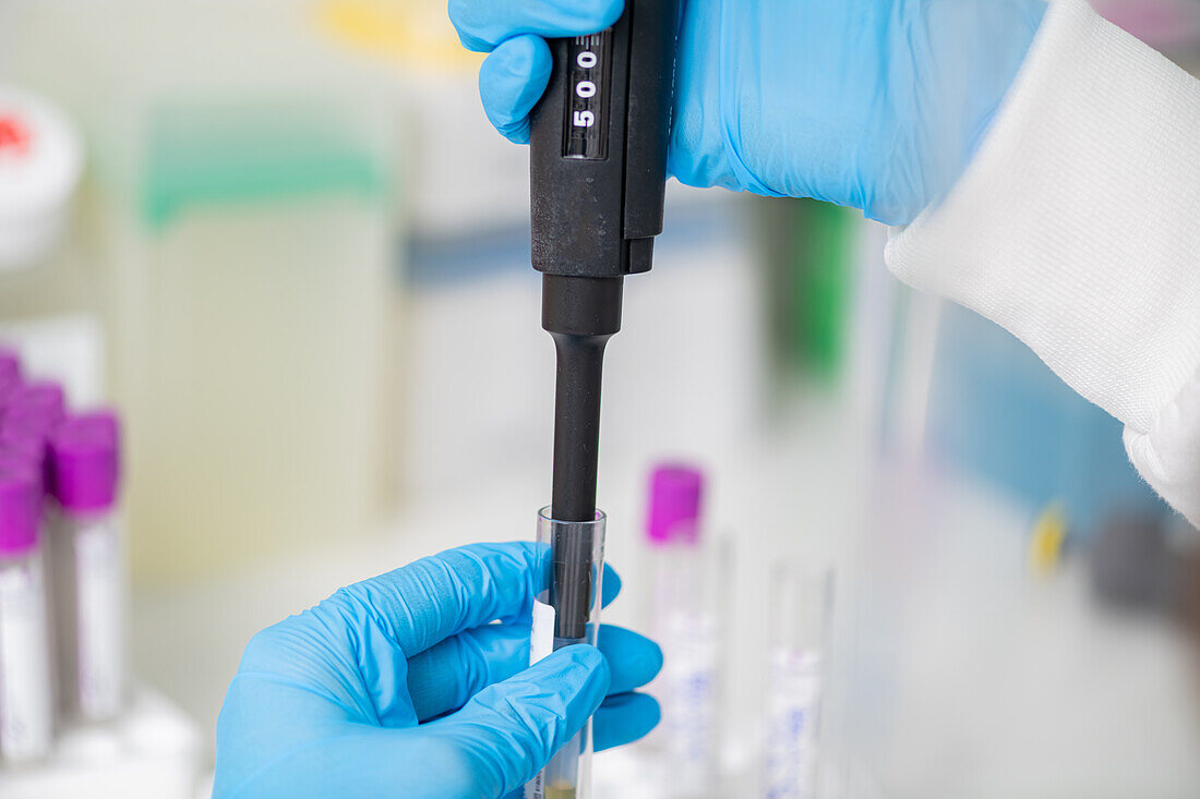 Researcher using a micropipette in a lab
