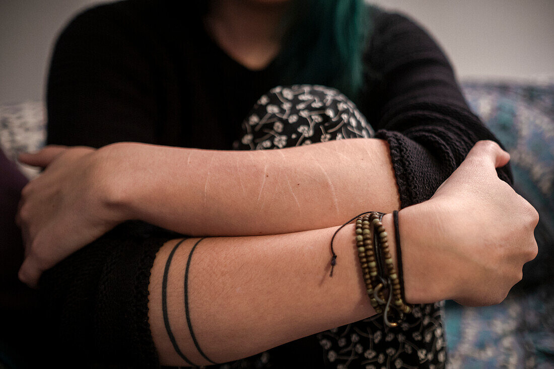 Womans arms with scars