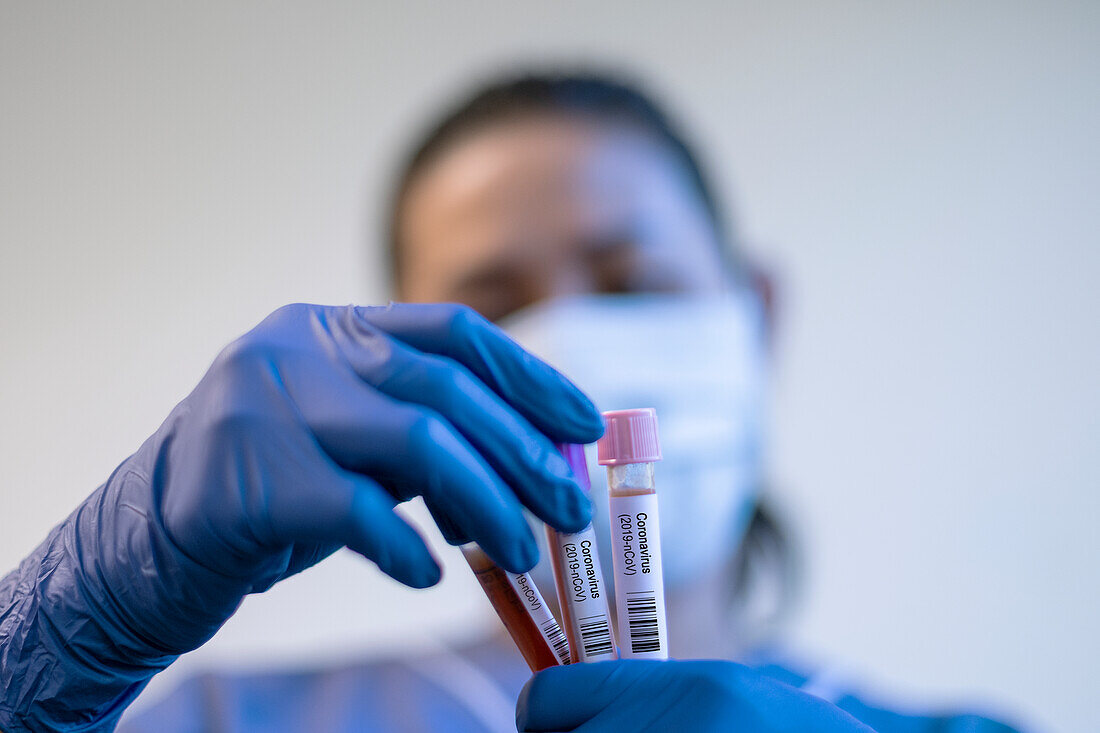 Scientist holding medical samples in test tubes