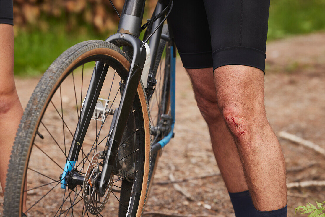 Männlicher Radfahrer mit aufgeschrammtem Knie