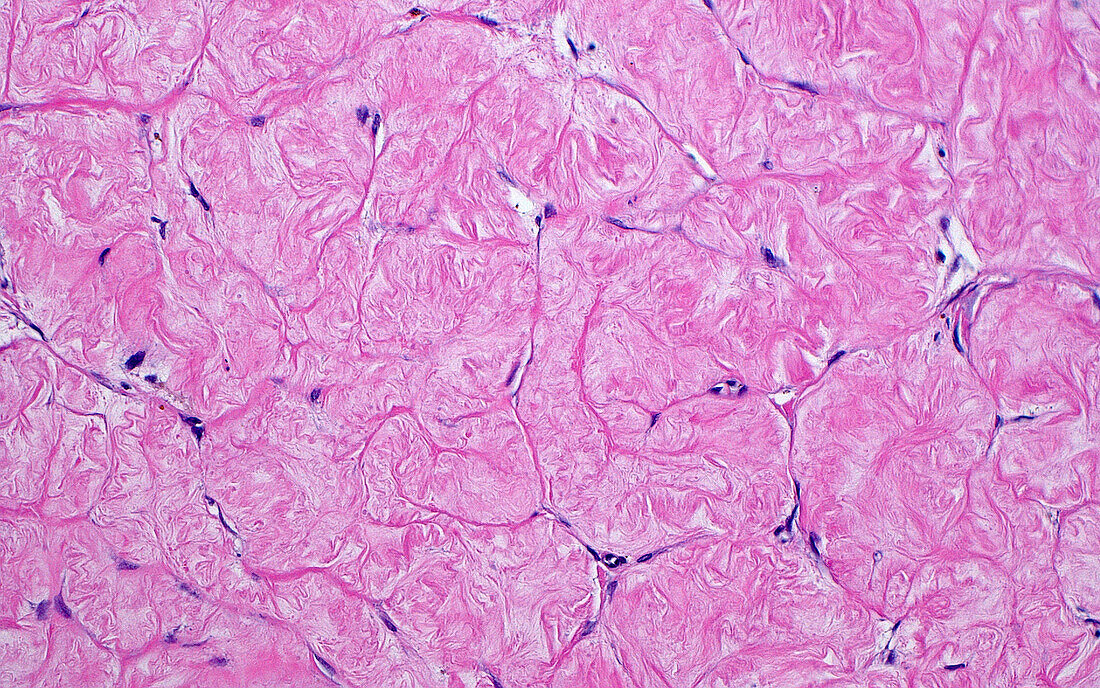 Ovary corpus albicans, light micrograph