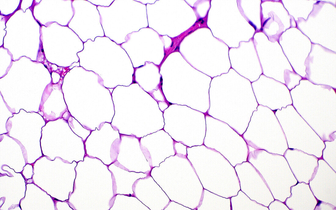 Fat cells, light micrograph