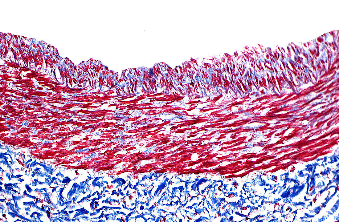 Blood vessel wall, light micrograph