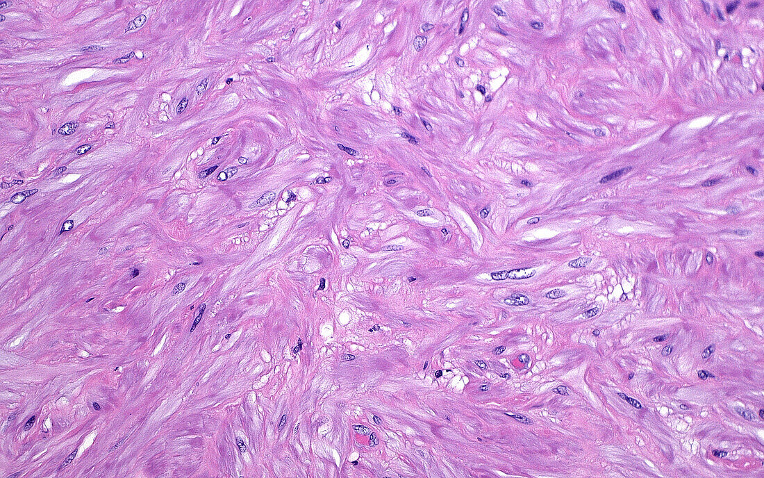 Seminal vesicle muscle wall, light micrograph