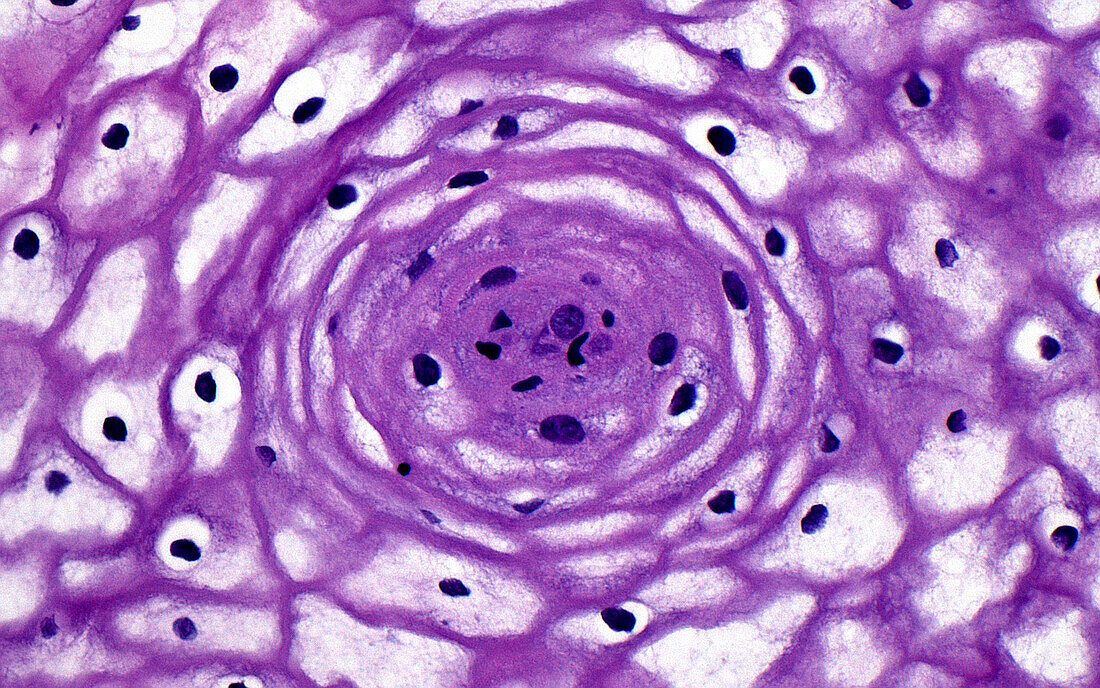 Cervix squamous cells, light micrograph