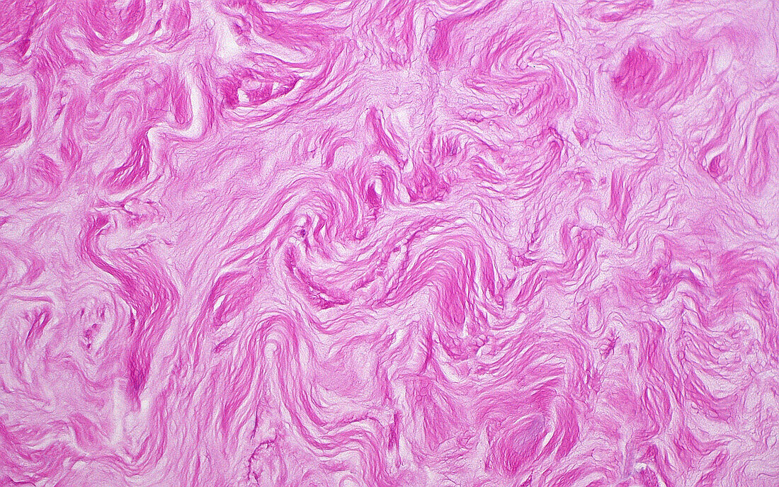 Collagen fibres in breast tissue, light micrograph