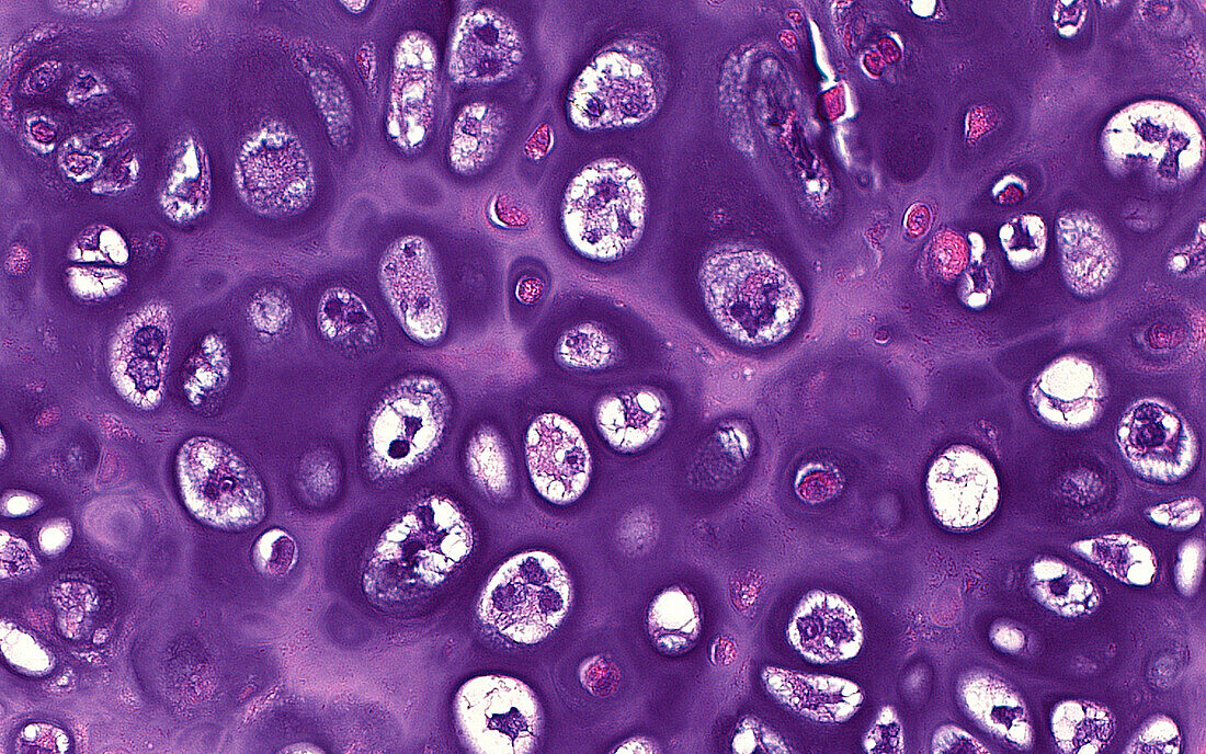 Cartilage cells, light micrograph