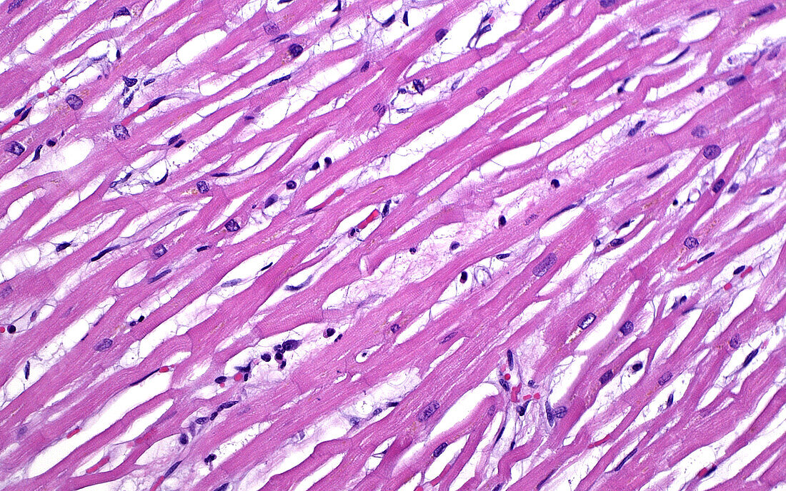 Heart muscle cells, light micrograph