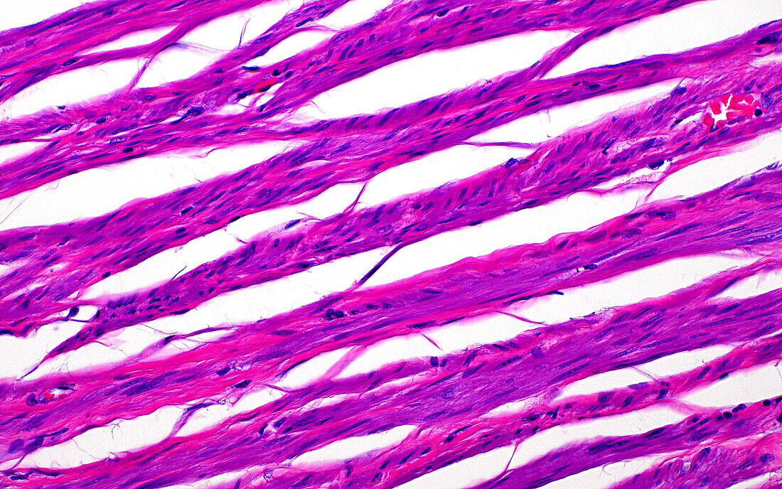 Smooth muscle in prostate, light micrograph