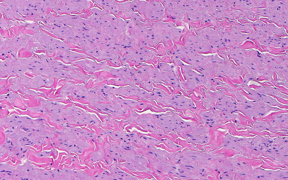 Smooth muscle in renal vein, light micrograph