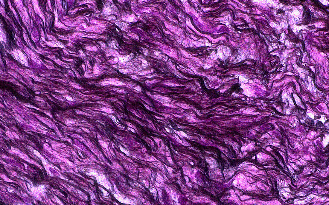 Collagen fibres silver stained, light micrograph