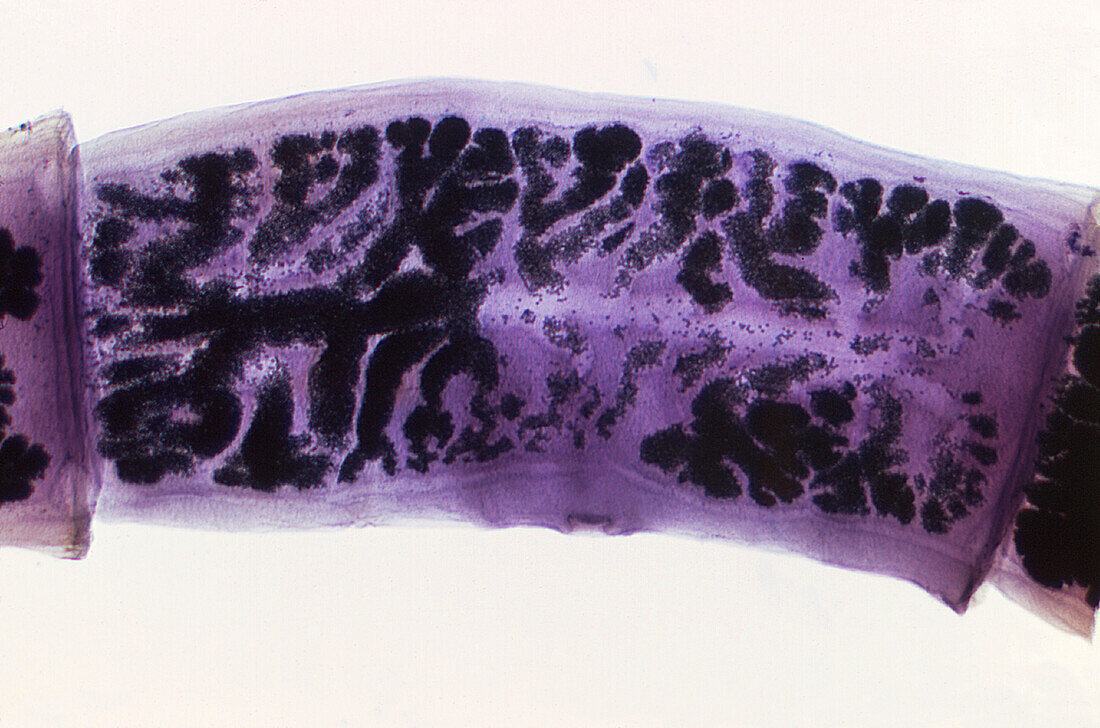 Taenia solium pig tapeworm proglottids, light micrograph