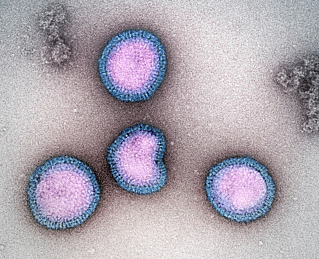 Influenza B virus particles, TEM