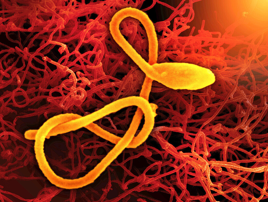 Ebola virus particles, composite SEMs