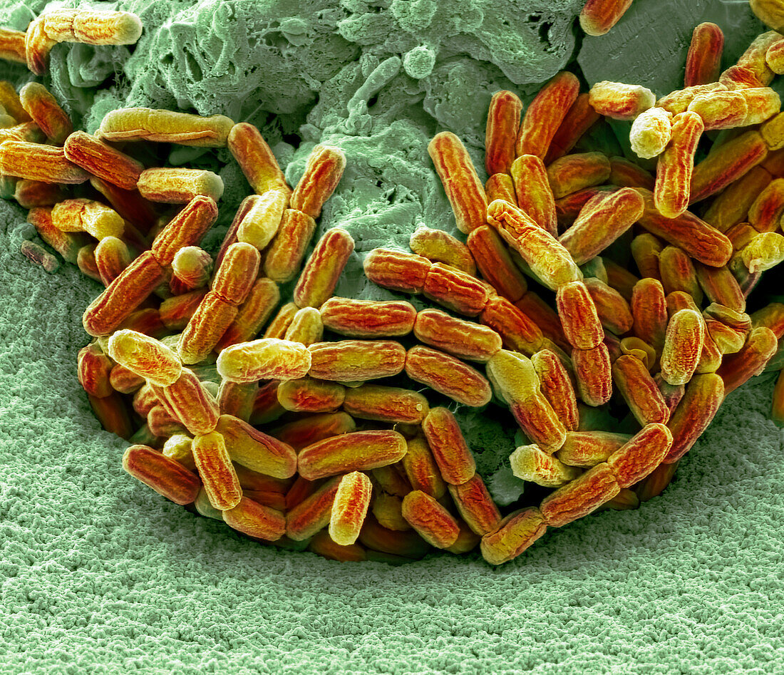 Bacteria from stagnant water, SEM