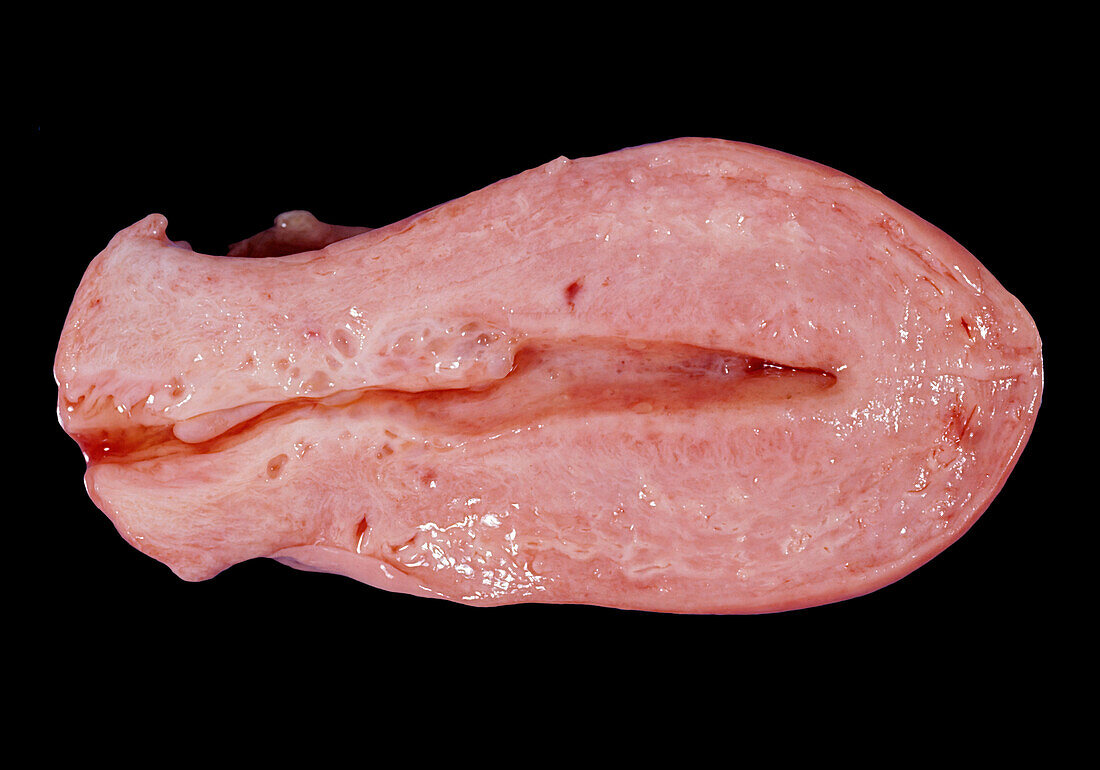 Human uterus