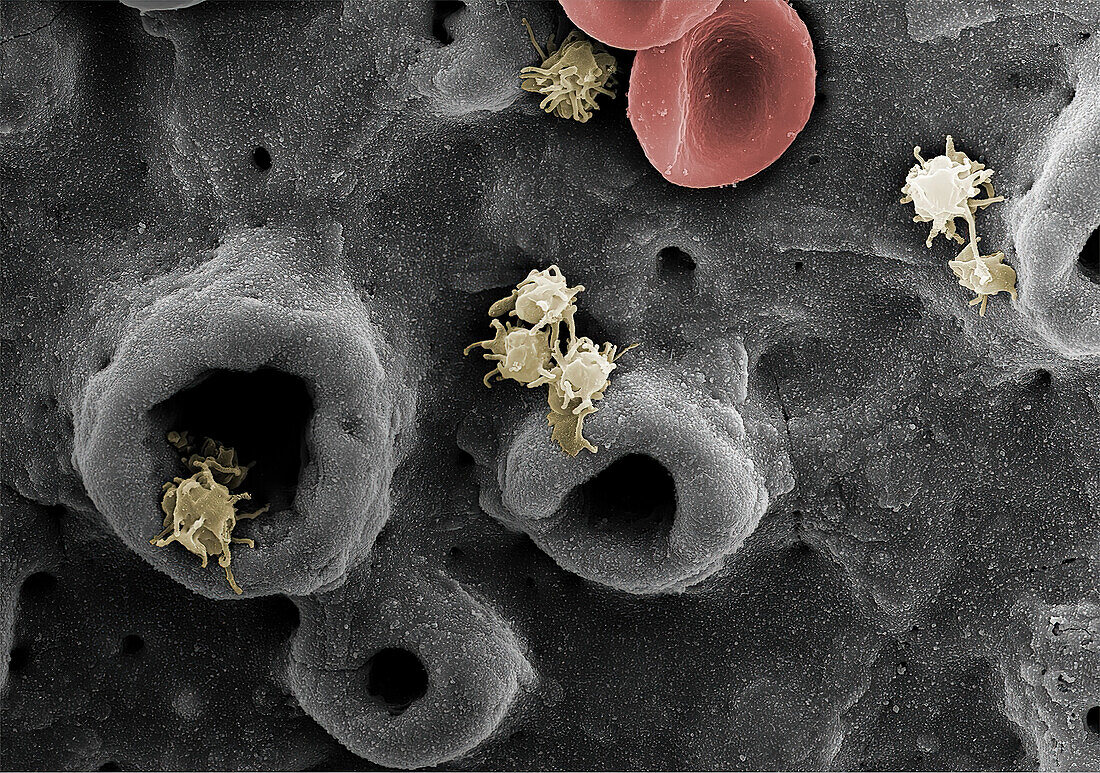 Platelets, SEM