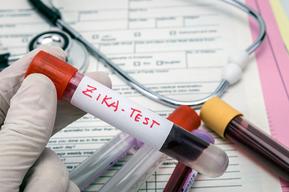 Zika virus test, conceptual image