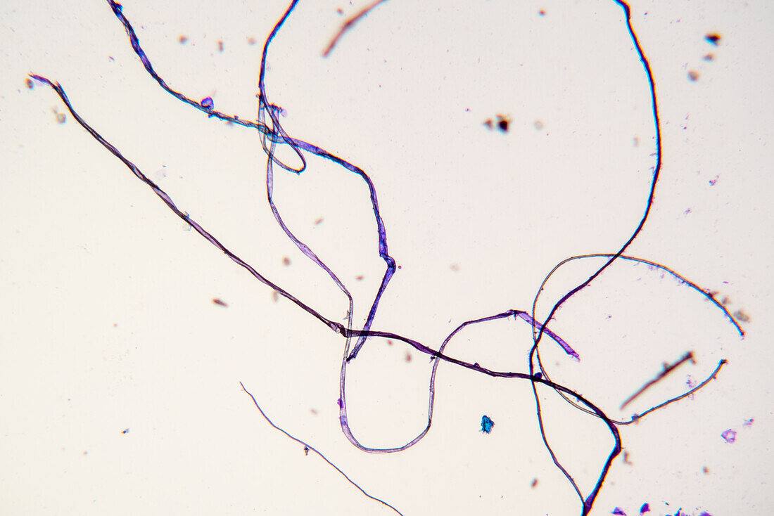 Tissue fibres, light micrograph