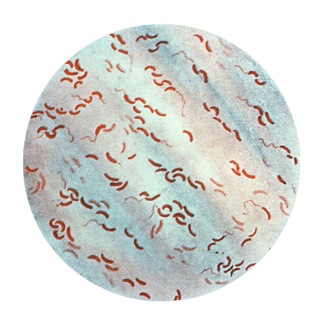Vibrio comma bacteria, light micrograph