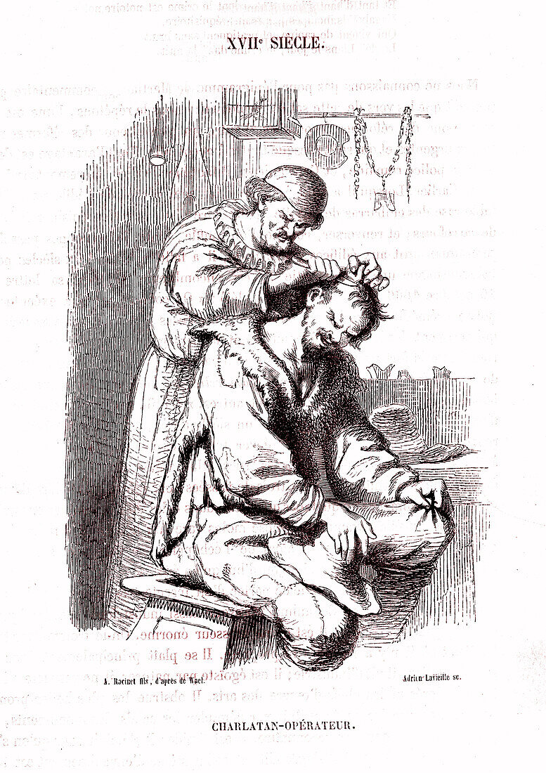 Barber surgeon, 19th century illustration