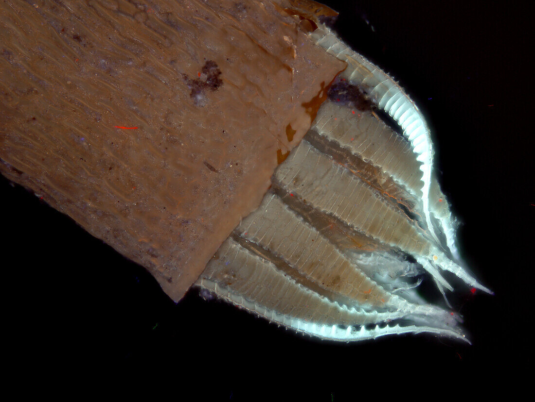 Moss sporangium, fluorescence micrograph