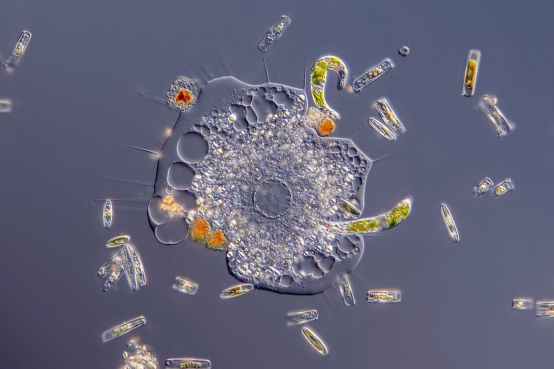 Amoeba with Euglena and diatoms, light micrograph