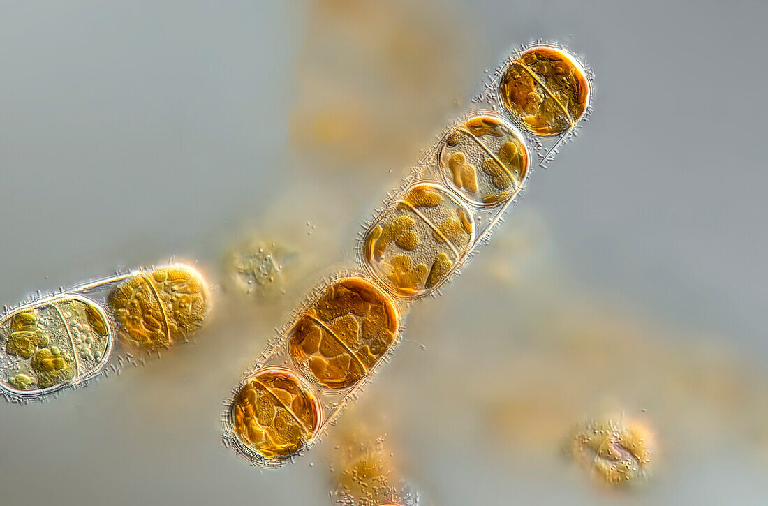 Melosira sp. algae, light micrograph