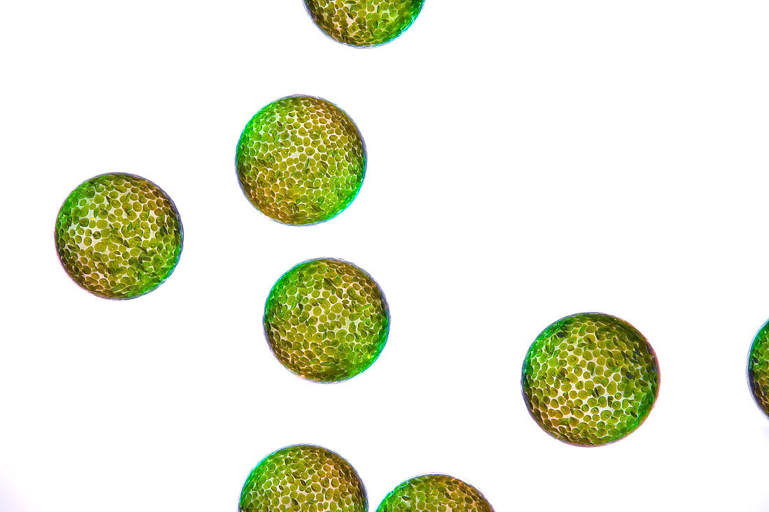 Eremosphaera viridis algae, light micrograph