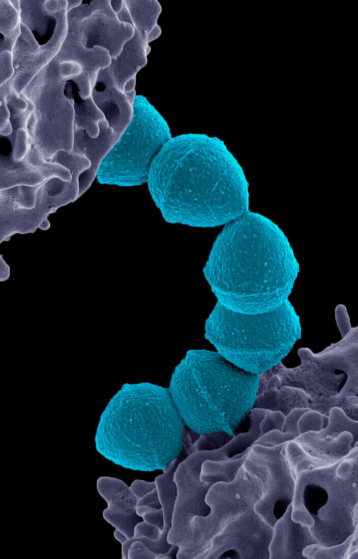 Group A Streptococcus bacteria, SEM