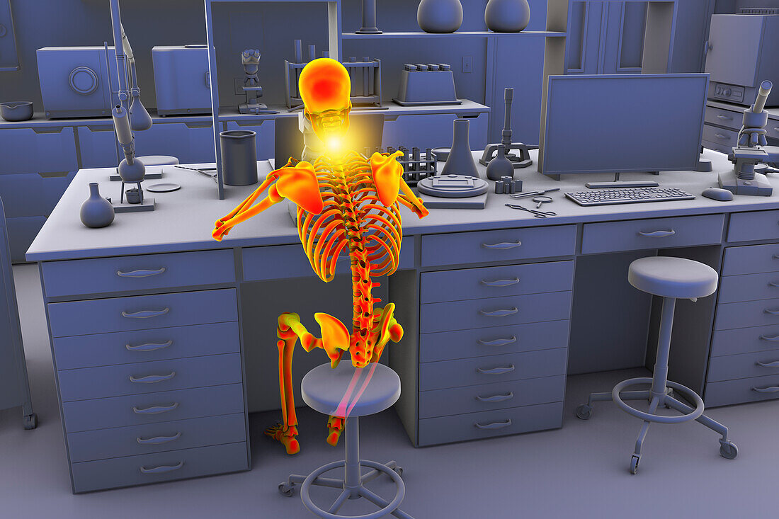 Musculoskeletal disorders in lab workers, illustration