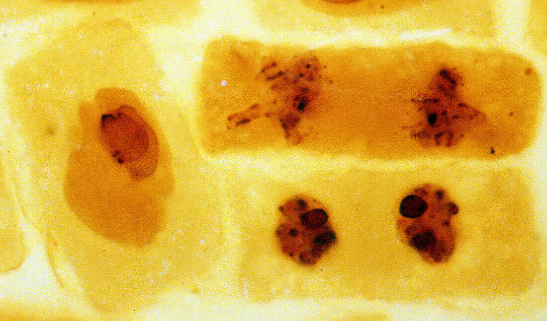 Nucleolar cycle, light micrograph