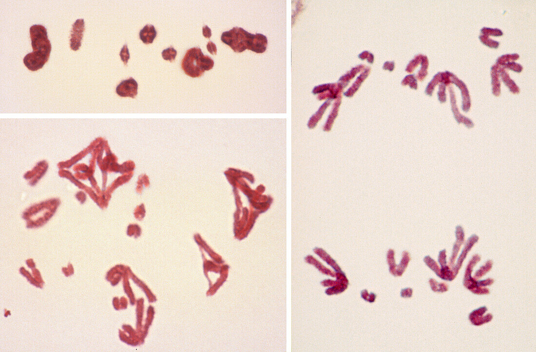 Meiosis, light micrograph