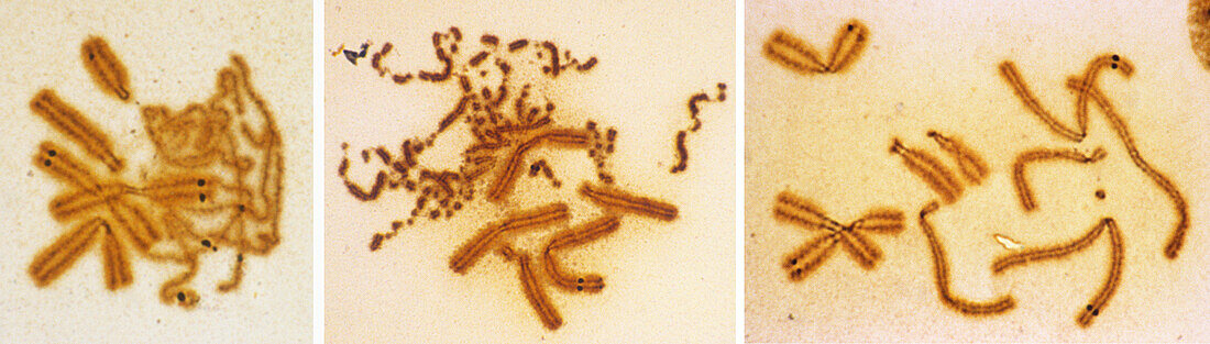 Premature chromosome condensation, light micrograph
