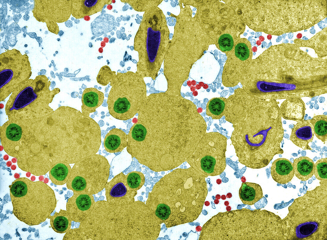 Maturing spermatozoa, TEM