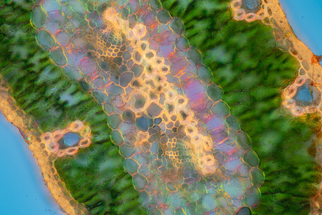 Scots pine (Pinus sylvestris) leaf, light micrograph
