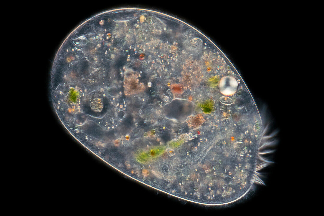 Stentor protozoan, light micrograph