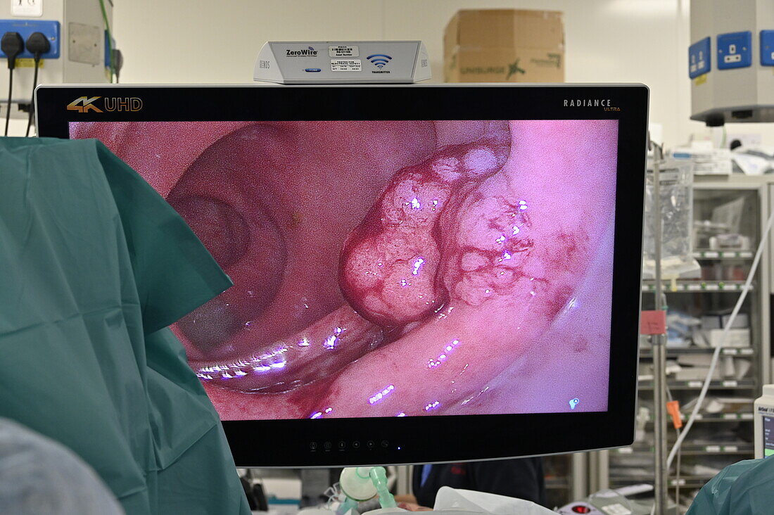 TAMIS endoscope video display