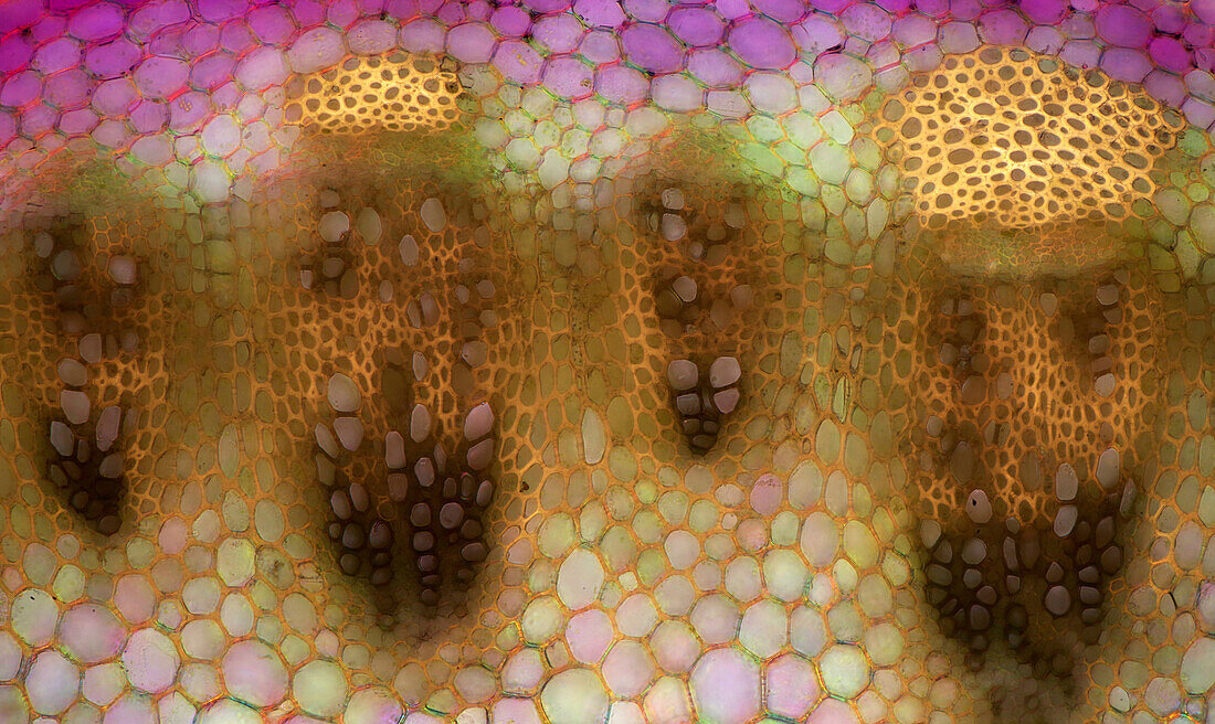 Narrowleaf lupin stalk, light micrograph